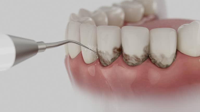 Trusted Wisdom Tooth Removal service in Inverness, CA - Dentist Open Now
